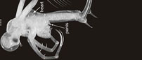 fish-hook water flea (Cercopagis pengoi)