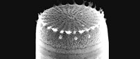 a diatom (Stephanodiscus binderanus)