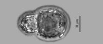 testate amoeba (Psammonobiotus spp)